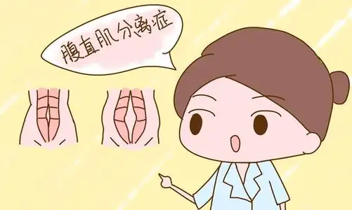 產(chǎn)后恢復(fù)的正確順序，你都知道嗎？
